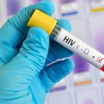 Visible-Signs-People-Have-HIV-1